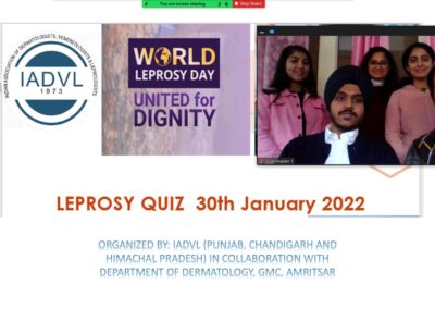 Leprosy quiz on World Leprosy Day