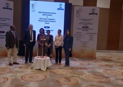 cme facial hyperpigmentation