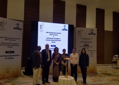 sig pigmentary disorders